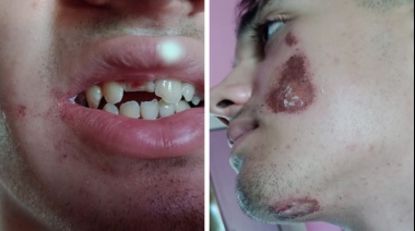 Otro ataque bestial en patota