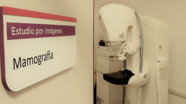 A partir de agosto se realizan mamografías con turno