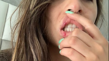 Escrachó a su ex en las redes por romper constantemente la perimetral 