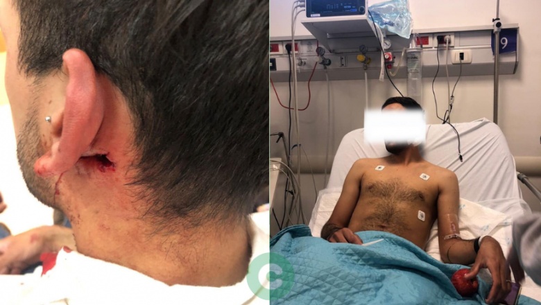 Casi lo matan a la salida de una fiesta: Buscan testigos