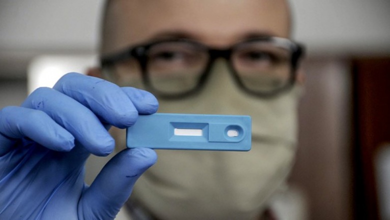 La ANMAT aprobó el primer test rápido argentino